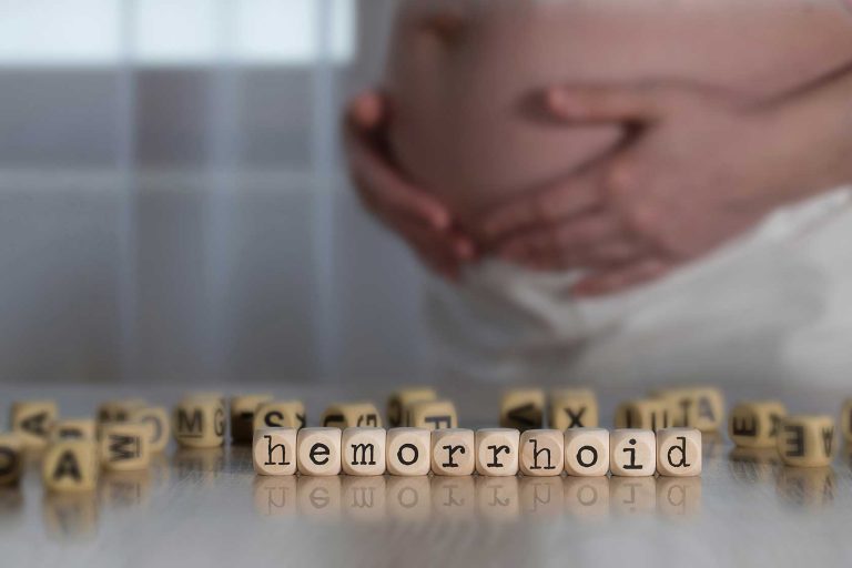 چگونه از هموروئید در بارداری پیشگیری کنیم؟